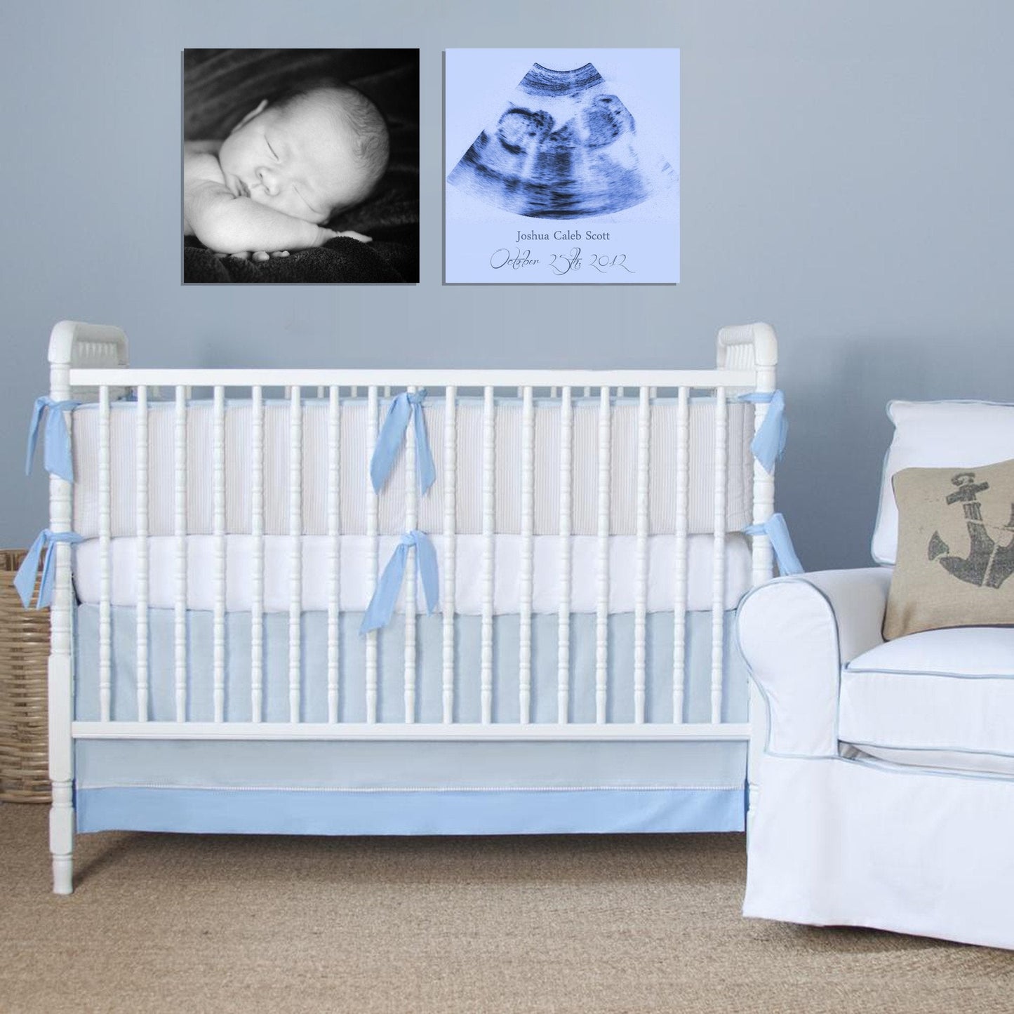 Custom Ultrasound Canvas